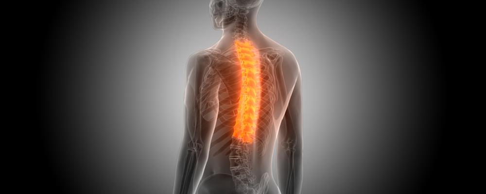 San Antonio Spinal Cord Injury Lawyer